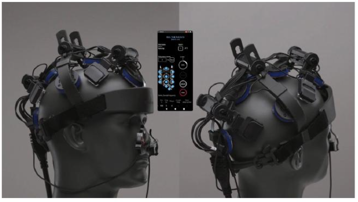 Vielight Brain Photobiomodulation